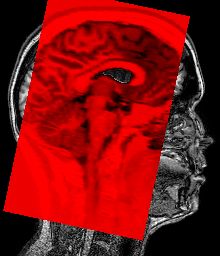 NIfTI image transform