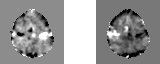 PeriVolume
