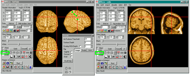 Volume Rendering The Cortex