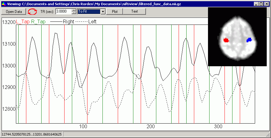 Timeline